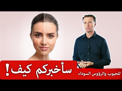 أوقفوا منتجات الوجه واتبعوا هذه الوصفة لبشرة صافية خالية من الحبوب