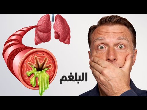 سبب وجود المخاط والبلغم المزمن في الحلق 0 71