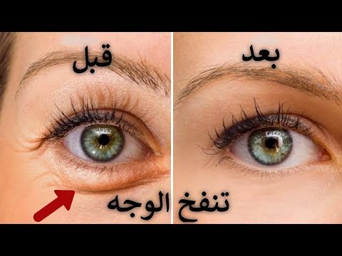 السبب في تنفخ الوجه والعين وطريقه العلاج