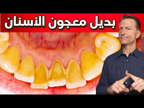 معجون الاسنان كارثه للفم لا يعلمها الكثير 0 52