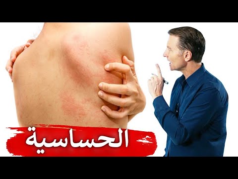 نبذه عن الهستامين والتخلص من حساسيه الانف 0 158