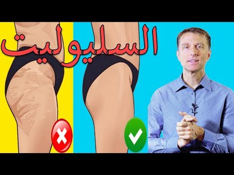 اسباب السيلوليت التي لا يعرفها الكثير 0 175