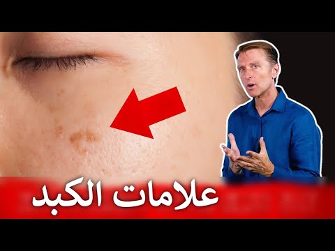 تسع علامات تنذرك بتراكم السموم في الكبد