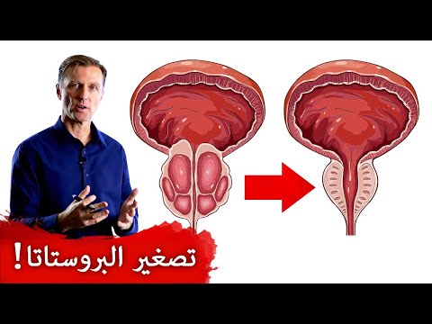 البروستاتا تتضخم اوقفها فورا وحافظ عليها 0 47