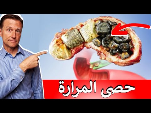 مؤشرات تخبرك بوجود حصى المراره 0 115