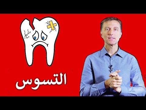 القضاء على تسوس الاسنان للكبار والصغار 0 93