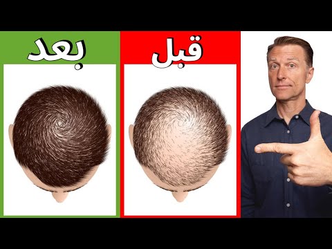 12 وصفة طبيعية للتخلص من تساقط الشعر وجعله قوي وجميل