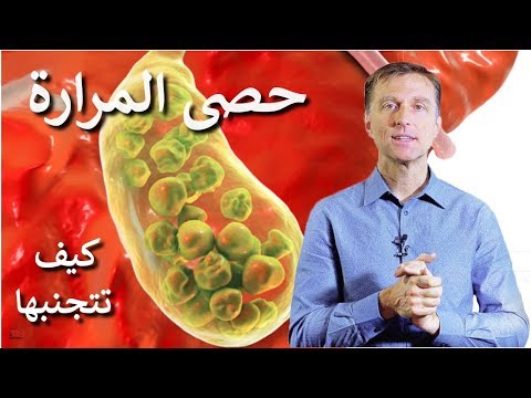 سبب وجود حصى المراره وكيفيه تجنبها 0 128