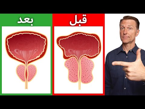 أهم عنصر غذائي على الاطلاق لتصغير البروستاتا | تخلص الى الابد من تكرار التبول وتضخم البروستاتا 0 17