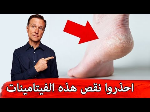 اعراض تظهر على الجلد والاظافر لنقص الفيتامينات 0 76