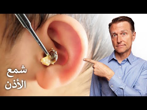 تنظيف الاذن من تراكم الشمع