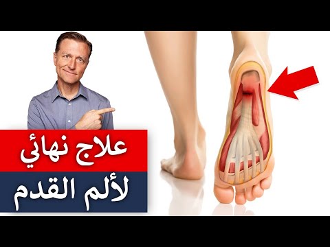 القضاء على الم الكعب وما سبب التهاب اللفافه الاخمصيه 0 130