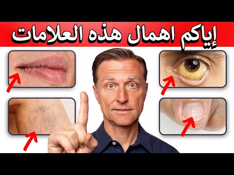 علامات تظهر بالجسم تخبرك بحاجه هذه الفيتامينات 0 87