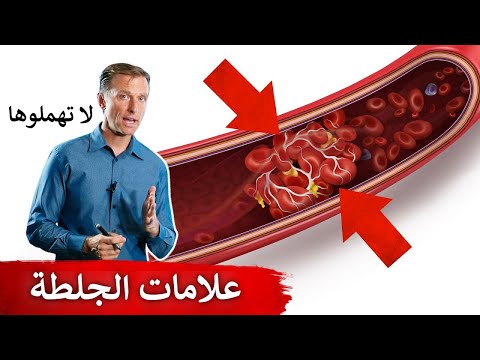 علامات جلطه القلب والرئه انتبهوا لها