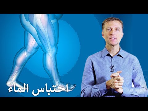 العلاج الفعال للتخلص من احتباس الماء الزائد بالجسم