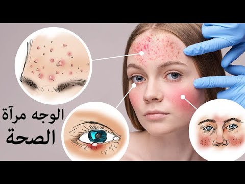 بالتاكيد ملامح الوجه هي مراّه للصحه