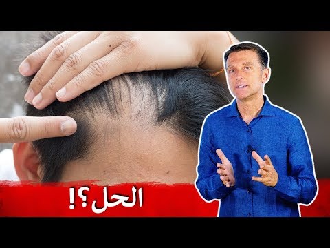 كيف تتجنب تراجع الشعر وعلاجه | دكتور بيرج 0 24