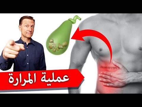 النواتج من عمليه ازاله المراره واهميتها