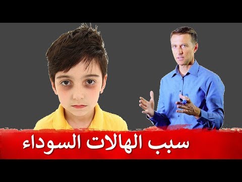 سبب السواد تحت العين لدى الطفل 0 181