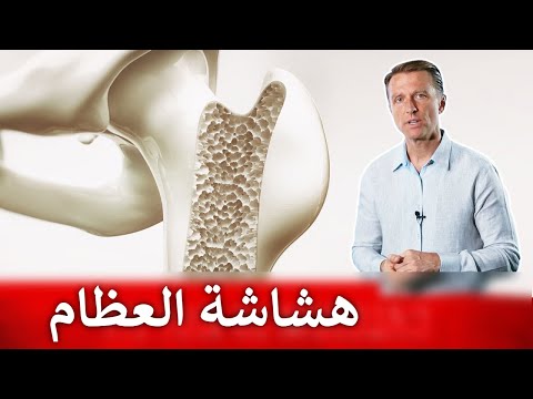 مكمل غذائي خطر يؤدي للاصابه بالنوبات القلبيه 0 124