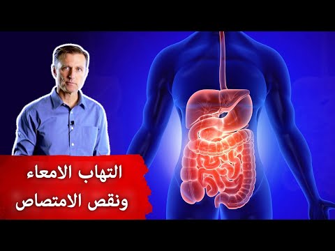 علاج طبيعي للقضاء على التهاب الامعاء 0 106