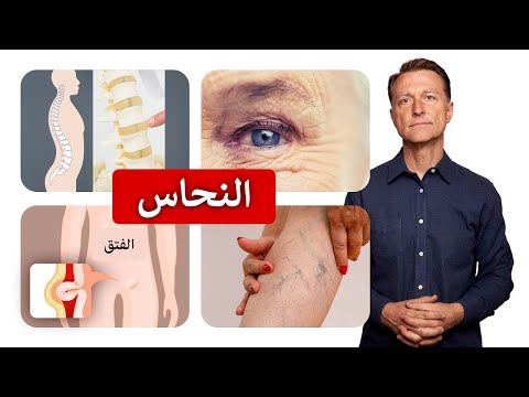 زيادة الكولاجين بالجسم بالطعام الذي يمنع ترهل الجلد