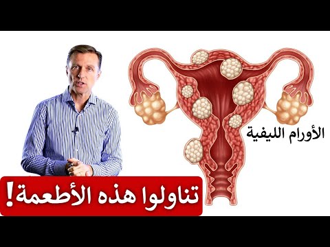 تقليص الاورام الليفيه بالاطعمه 0 20