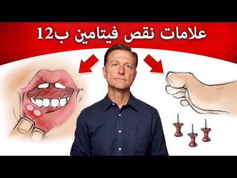 اطعمه مفيده تحتوي على فيتامين B12