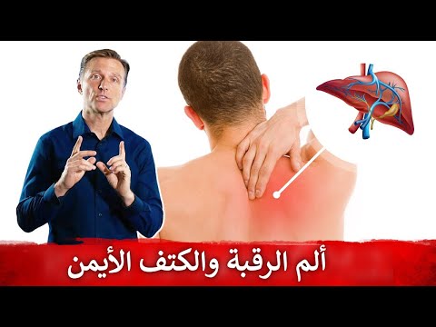 سبب الم الرقبه وعلاقته بمشكله في الكبد