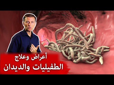 اعراض وجود الديديان بجسم الانسان و طرق القضاء عليها 0 78