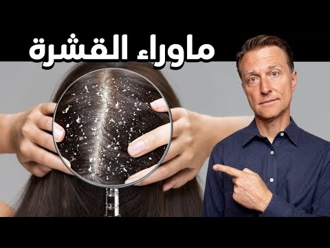 سبب وجود القشره في الشعر وطرق علاجها طبيعيا