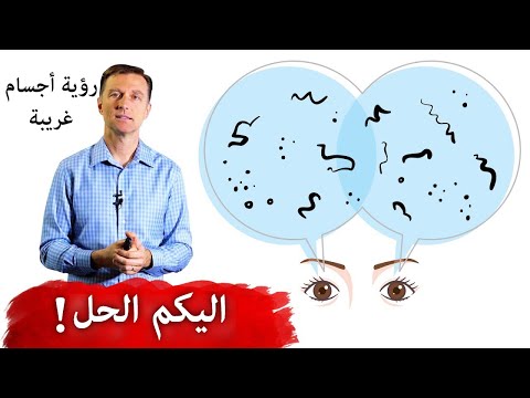 حل نهائي لمشكله عوائم العين 0 189