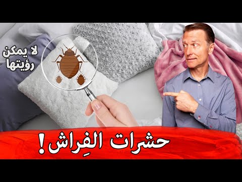 القضاء على حشرات الفراش 0 156