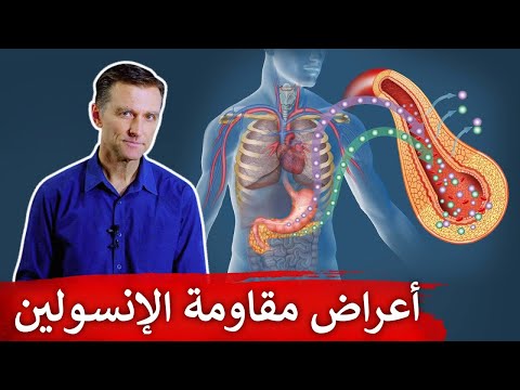 اعراض تدل على مقاومه الانسولين بالجسم 0 15