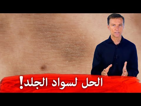 الحل النهائي للتخلص من سواد الابط والرقبه