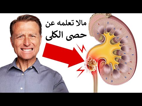 التخلص من حصى الكلى والالم بدون رجعه 0 249