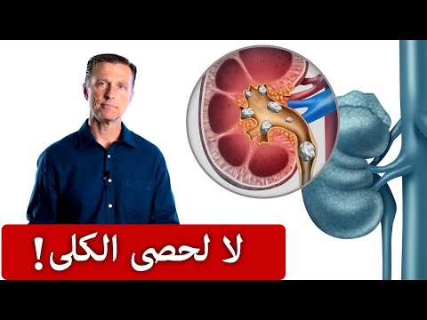 علامات مميزه جدا لوجود حصى في الكلى