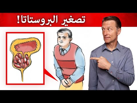 افضل الطرق لوقف تضخم البروستاتا وتكرار التبول 0 118