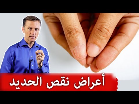 اسباب واعراض نقص الحديد وفقر الدم 0 254