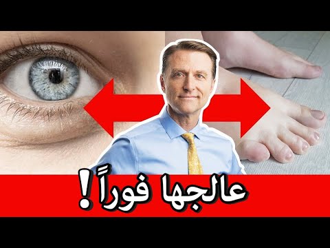 مرض الكلى واهم علاماته المبكره وافضل طعام له 0 113