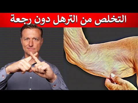 الحصول على جلد مشدود بدون ترهل 0 162