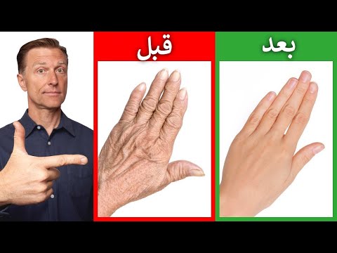 أفضل وصفة على الإطلاق لليدين الجافة والمتجعّدة- 0 19