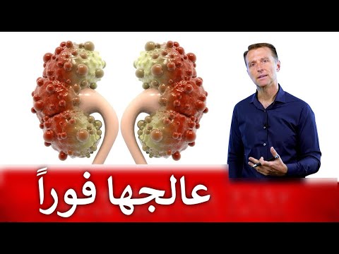 عشبة مهمة تساعد في رفع كفاءة الكلية 0 60