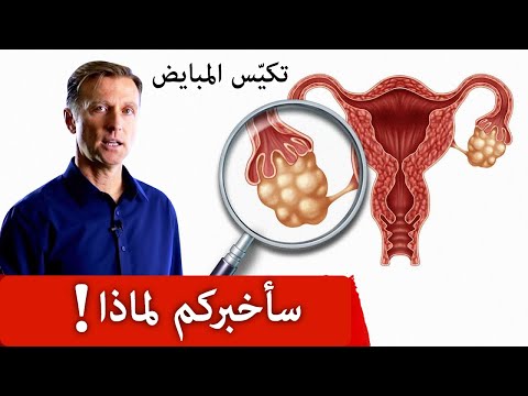 ما السبب الرئيسي في تكيس المبايض