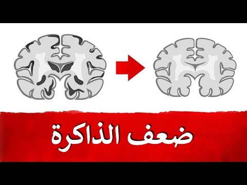 السبب في ضعف الذاكره وضمور الدماغ